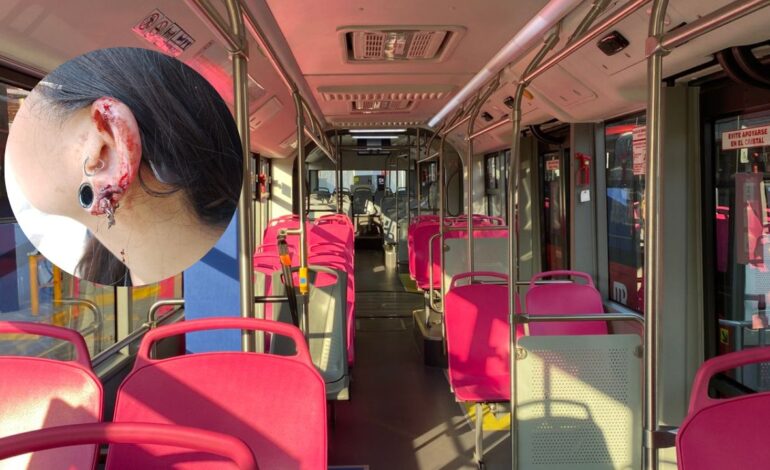 Sujeto arranca un pedazo de oreja a mujer en el Metrobús